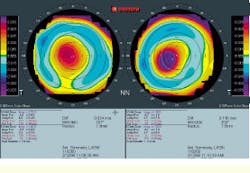 Th Vsd51849 35 Th Vsd51849 35