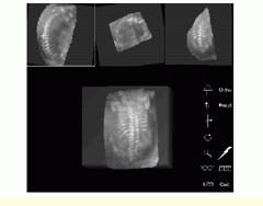 Th Vsd52009 55 Th Vsd52009 55