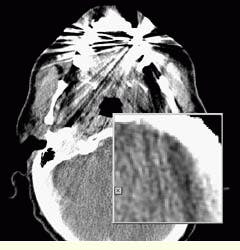 Th Vsd52218 82 Th Vsd52218 82