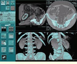 Th Vsd52277 58 Th Vsd52277 58