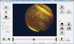 Vsdtrend2endo100511 Vsdtrend2endo100511