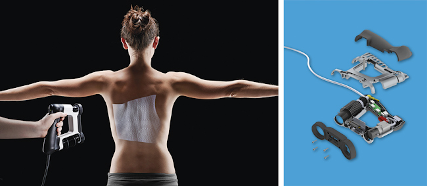 Lighting and Illumination Pattern projector aids prosthetics maker