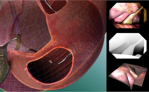 Content Dam Vsd En Articles 2013 06 Kinect Will Be Used To Perform Surgery Leftcolumn Article Thumbnailimage File