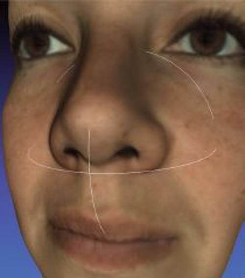 Content Dam Vsd En Articles 2013 08 Point And Shoot 3d Scanner For Less Than 1 000 Leftcolumn Article Thumbnailimage File