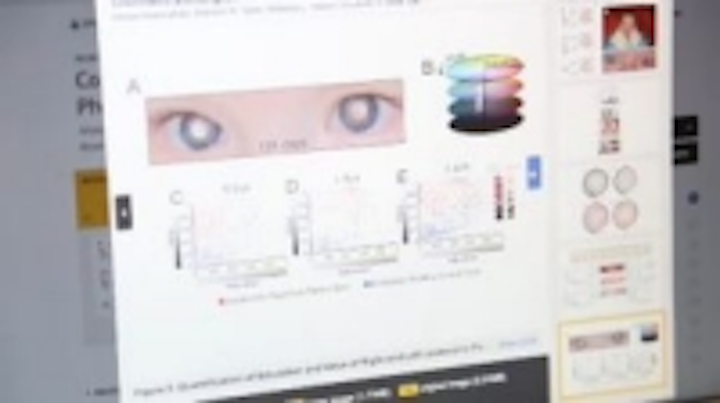 Content Dam Vsd En Articles 2013 11 Academic Researchers Working To Create Pediatric Eye Cancer Detection Software Leftcolumn Article Thumbnailimage File