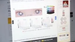 Content Dam Vsd En Articles 2013 11 Academic Researchers Working To Create Pediatric Eye Cancer Detection Software Leftcolumn Article Thumbnailimage File
