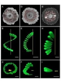 Content Dam Vsd En Articles 2013 11 X Ray And 3d Imaging Techniques Used To Non Destructively Visualize Ancient Fossils Leftcolumn Article Thumbnailimage File Content Dam Vsd En Articles 2013 11 X Ray And 3d Imaging Techniques Used To Non Destructively Visualize Ancient Fossils Leftcolumn Article Thumbnailimage File