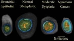 Content Dam Vsd En Articles 2013 12 Five Ways Vision Systems Improved Lives In 2013 Leftcolumn Article Thumbnailimage File Content Dam Vsd En Articles 2013 12 Five Ways Vision Systems Improved Lives In 2013 Leftcolumn Article Thumbnailimage File