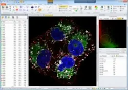 Content Dam Vsd En Articles 2013 12 Media Cybernetics Launches New Image Pro Image Analysis Software Leftcolumn Article Thumbnailimage File Content Dam Vsd En Articles 2013 12 Media Cybernetics Launches New Image Pro Image Analysis Software Leftcolumn Article Thumbnailimage File