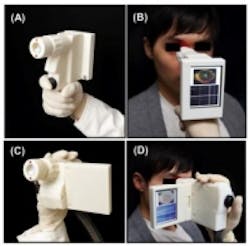 Content Dam Vsd En Articles 2013 12 Mit Develops Hand Held Scanner For Detecting Eye Disease Leftcolumn Article Thumbnailimage File Content Dam Vsd En Articles 2013 12 Mit Develops Hand Held Scanner For Detecting Eye Disease Leftcolumn Article Thumbnailimage File