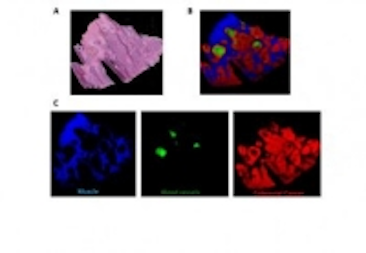 Content Dam Vsd En Articles 2014 01 Chemical Imaging Technique Could Improve Diseased Tissue Analysis Leftcolumn Article Thumbnailimage File
