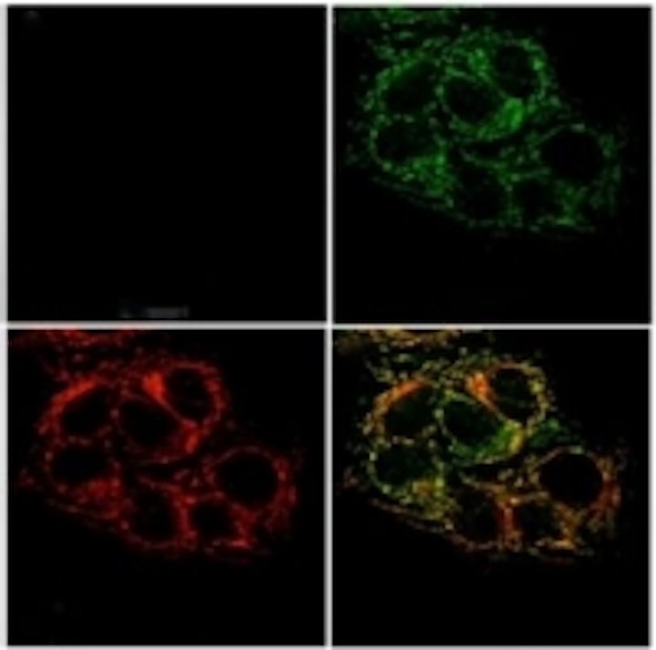 Content Dam Vsd En Articles 2014 01 Optical Sensor Tracks Zinc In Cells For Cancer Research Leftcolumn Article Thumbnailimage File