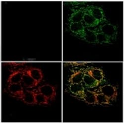 Content Dam Vsd En Articles 2014 01 Optical Sensor Tracks Zinc In Cells For Cancer Research Leftcolumn Article Thumbnailimage File Content Dam Vsd En Articles 2014 01 Optical Sensor Tracks Zinc In Cells For Cancer Research Leftcolumn Article Thumbnailimage File