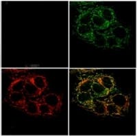 Content Dam Vsd En Articles 2014 01 Optical Sensor Tracks Zinc In Cells For Cancer Research Leftcolumn Article Thumbnailimage File