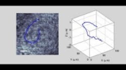 Content Dam Vsd En Articles 2014 02 Scientists Capture First 3d Movie Of Living Sperm Leftcolumn Article Thumbnailimage File Content Dam Vsd En Articles 2014 02 Scientists Capture First 3d Movie Of Living Sperm Leftcolumn Article Thumbnailimage File