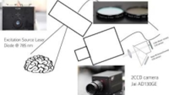 Content Dam Vsd En Articles 2014 02 Vision System Uses Scorpion Venom Protein And A Laser To Identify Tumors Leftcolumn Article Thumbnailimage File