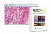 Content Dam Vsd En Articles 2014 12 Spot Imaging Solutions Releases Latest Version Of Microscopy Imaging Software Leftcolumn Article Thumbnailimage File