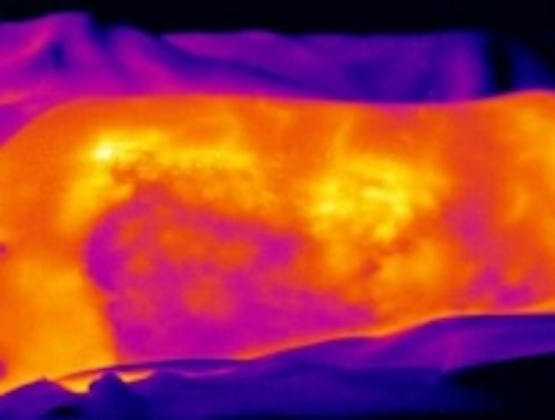 Content Dam Vsd En Articles 2015 02 Infrared Imaging Helps Assess Burn Wounds For Treatment Evaluation Leftcolumn Article Thumbnailimage File