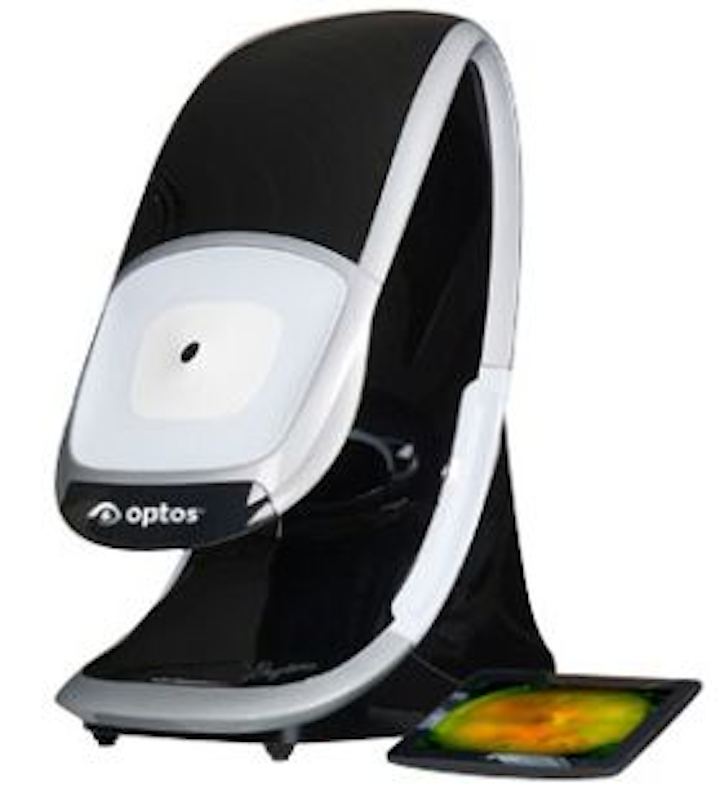 Nikon expands into medical imaging with acquisition of Optos Vision