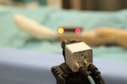 Content Dam Vsd En Articles 2015 04 Vision Assists In Artificial Hip Replacement Procedures Leftcolumn Article Thumbnailimage File Content Dam Vsd En Articles 2015 04 Vision Assists In Artificial Hip Replacement Procedures Leftcolumn Article Thumbnailimage File