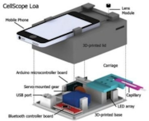 Content Dam Vsd En Articles 2015 05 Iphone Microscope Automates Detection Of Parasites In Blood Leftcolumn Article Thumbnailimage File