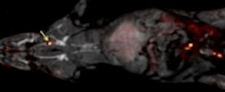 Content Dam Vsd En Articles 2015 08 Imaging Technique Could Detect Blood Clots In A Single Scan Leftcolumn Article Thumbnailimage File