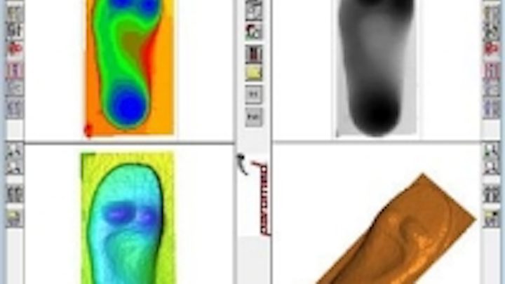 Content Dam Vsd En Articles 2015 10 3d Cameras Ensure The Accurate Development Of Custom Shoe Insoles Leftcolumn Article Thumbnailimage File