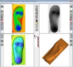 Content Dam Vsd En Articles 2015 10 3d Cameras Ensure The Accurate Development Of Custom Shoe Insoles Leftcolumn Article Thumbnailimage File Content Dam Vsd En Articles 2015 10 3d Cameras Ensure The Accurate Development Of Custom Shoe Insoles Leftcolumn Article Thumbnailimage File