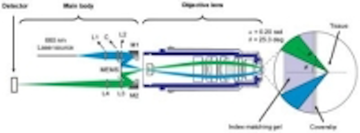 Content Dam Vsd En Articles 2016 02 Page 2 Handheld Microscope Could Identify Cancer Cells Leftcolumn Article Thumbnailimage File