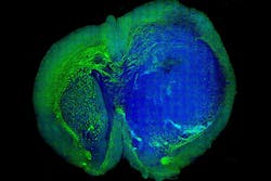 Content Dam Vsd En Articles Slideshow 2013 10 Five Unique Examples Of Innovative Medical Imaging Leftcolumn Article Thumbnailimage File Content Dam Vsd En Articles Slideshow 2013 10 Five Unique Examples Of Innovative Medical Imaging Leftcolumn Article Thumbnailimage File