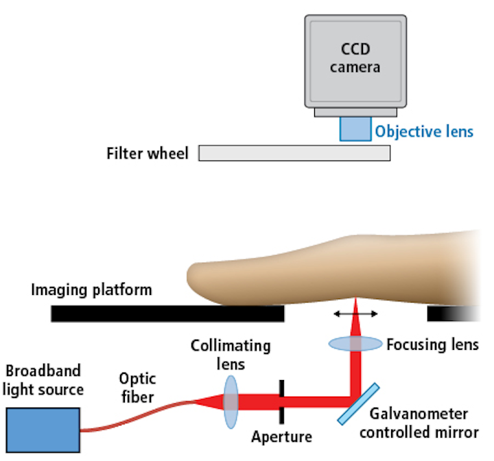 Fouriertransform analysis helps optical method improve RA detection