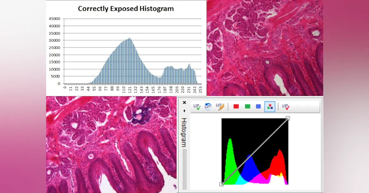 Using Histograms to Understand Your Vision System Image Data | Vision ...