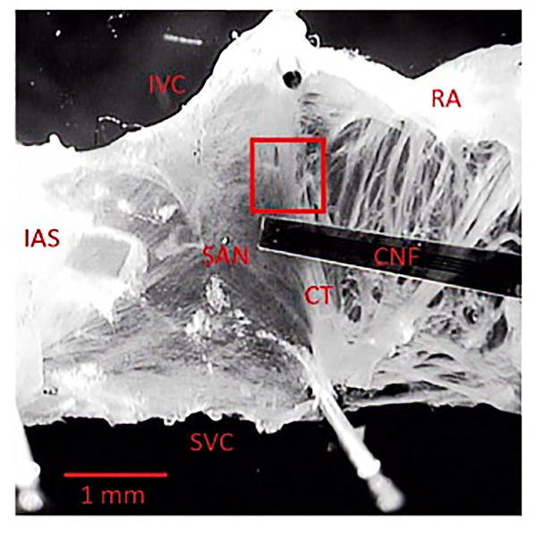 A sample tissue image preparation includes the intact atria and the region of the SAN. The following areas can be seen in the image: RA, right atrium; CT, crista terminalis; IAS, interatrial septum; IVC, inferior vena cava; SVC, superior vena cava; CNF, cardiac-near-field electrode. The 160 x 160 pixel ROI (red rectangle) was set to a region yielding high changes of average grey values.
