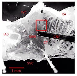 A sample tissue image preparation includes the intact atria and the region of the SAN. The following areas can be seen in the image: RA, right atrium; CT, crista terminalis; IAS, interatrial septum; IVC, inferior vena cava; SVC, superior vena cava; CNF, cardiac-near-field electrode. The 160 x 160 pixel ROI (red rectangle) was set to a region yielding high changes of average grey values. A sample tissue image preparation includes the intact atria and the region of the SAN. The following areas can be seen in the image: RA, right atrium; CT, crista terminalis; IAS, interatrial septum; IVC, inferior vena cava; SVC, superior vena cava; CNF, cardiac-near-field electrode. The 160 x 160 pixel ROI (red rectangle) was set to a region yielding high changes of average grey values.