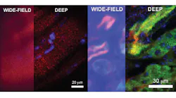 Microscopy With Computational Imaging