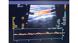3 D Imaging Ultrasound Vascular