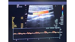 3 D Imaging Ultrasound Vascular 616853a7a149a 3 D Imaging Ultrasound Vascular 616853a7a149a