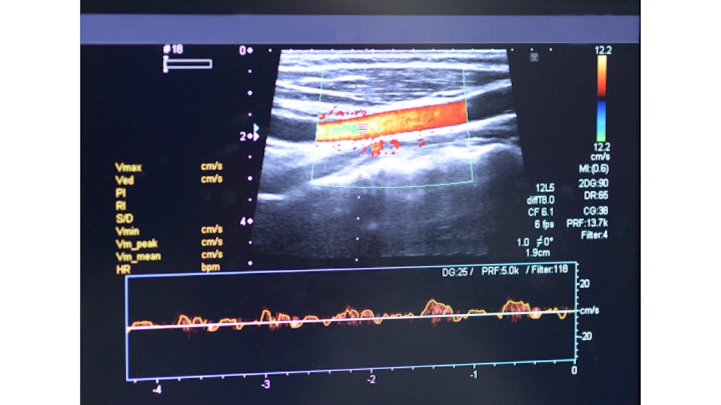 3 D Imaging Ultrasound Vascular