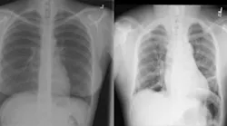 Medical Imaging Normal And Anomaly