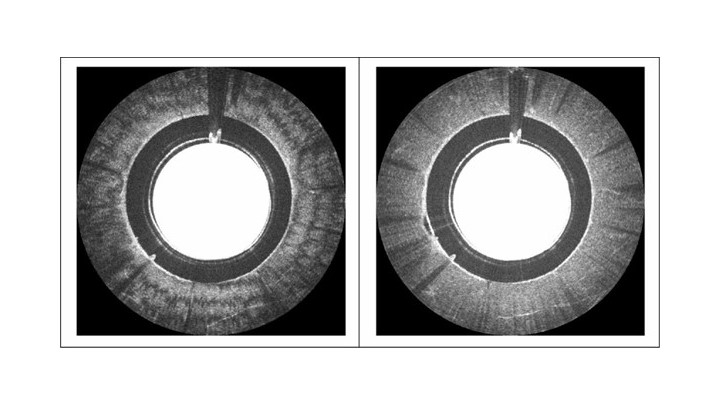 Image of chicken breast tissue acquired with OCT system without PIDU (left) and image of the same tissue acquired with OCT system with PIDU (right). (Image courtesy of Otuya, Sharma, Tearney, and Singh.)