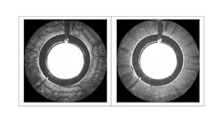 Image of chicken breast tissue acquired with OCT system without PIDU (left) and image of the same tissue acquired with OCT system with PIDU (right). (Image courtesy of Otuya, Sharma, Tearney, and Singh.)