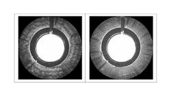 Image of chicken breast tissue acquired with OCT system without PIDU (left) and image of the same tissue acquired with OCT system with PIDU (right). (Image courtesy of Otuya, Sharma, Tearney, and Singh.) Image of chicken breast tissue acquired with OCT system without PIDU (left) and image of the same tissue acquired with OCT system with PIDU (right). (Image courtesy of Otuya, Sharma, Tearney, and Singh.)