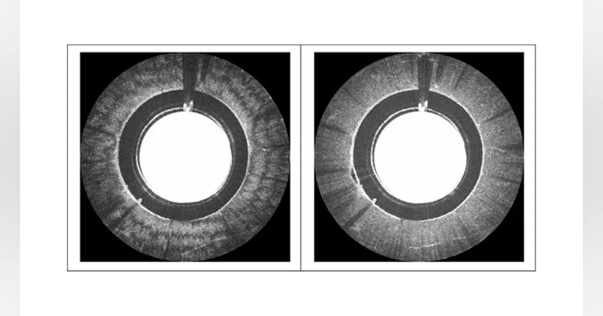 Researchers Develop Optical Tomography System with Frame Grabber ...