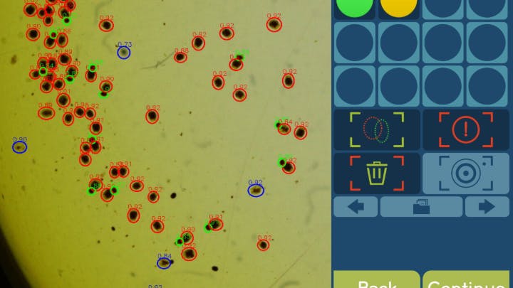 Figure 1: Using machine vision and AI, SnappArt automates the process of quantifying and assessing live feed used in hatcheries, such as the Rotifer pictured here.