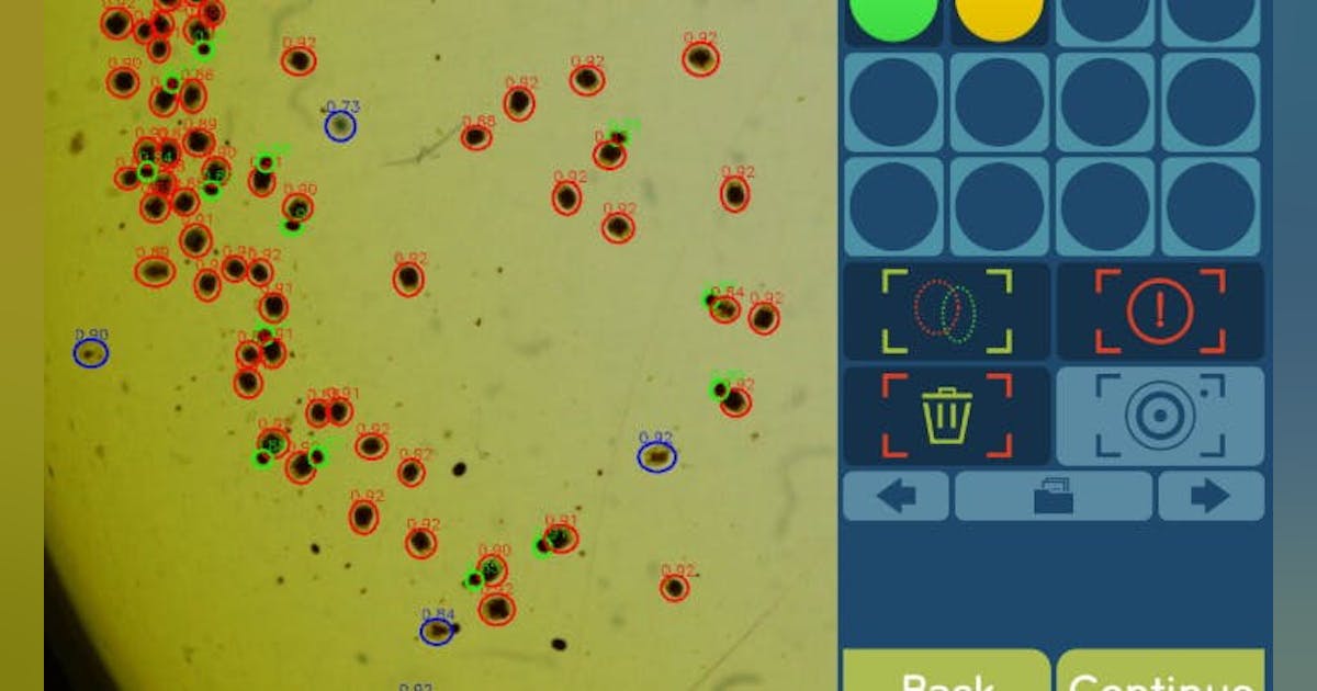 Machine Vision Tool Assesses Quality of Live Feed | Vision Systems Design