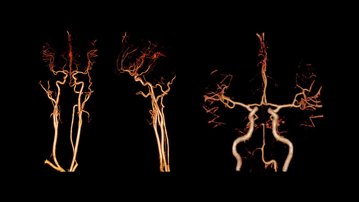 68c312fe841627dffb44ac71 Dreamstime Xxl 154454133