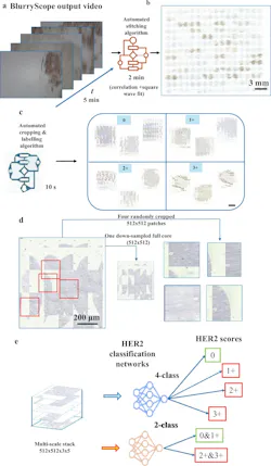 Flowchart of the BlurryScope data pipeline: motion-blurred video frames are stitched into a core mosaic, automatically cropped and labeled, converted into multiscale patches, and passed to four-class and two-class HER2 classification networks.